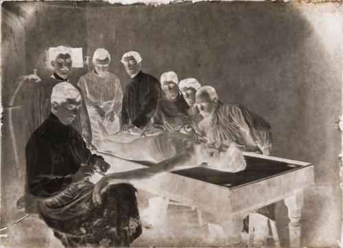 Rodríguez, Melitón : Dos placas secas de gelatina (dry plate) de una autopsia