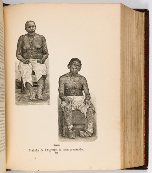El Médico práctico doméstico y enciclopedia de medicina [mi